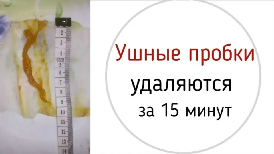 Технические особенности